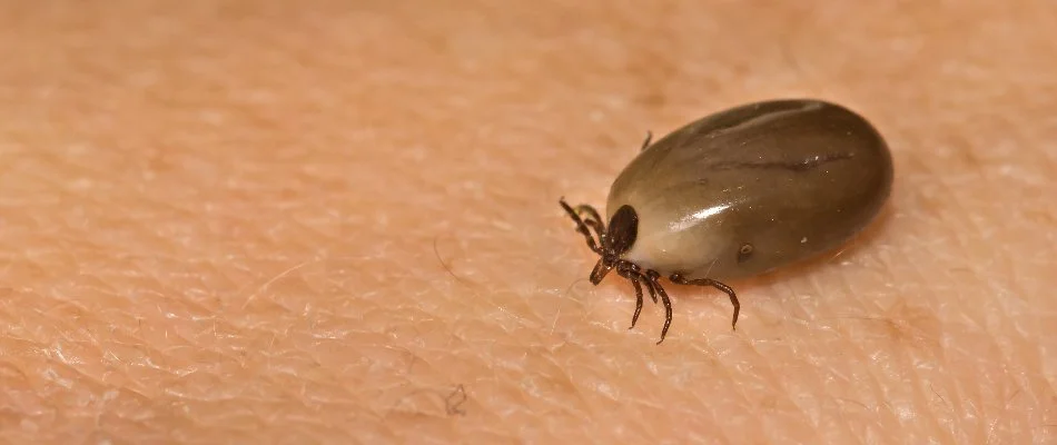Engorged tick on skin in Miramar, FL.